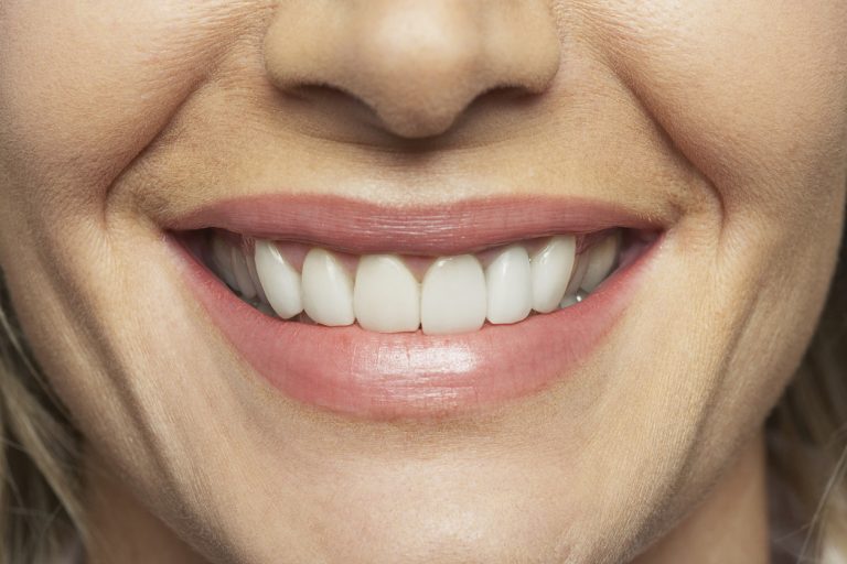 Your Dentist In Spring, TX Explains Why Some Crowns Look Bad - Gary